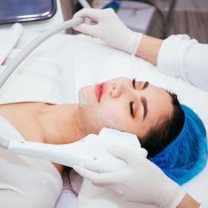 IPL Acne Treatment