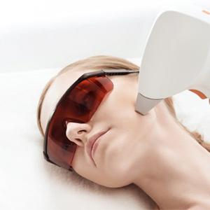 IPL Rosacea Treatment